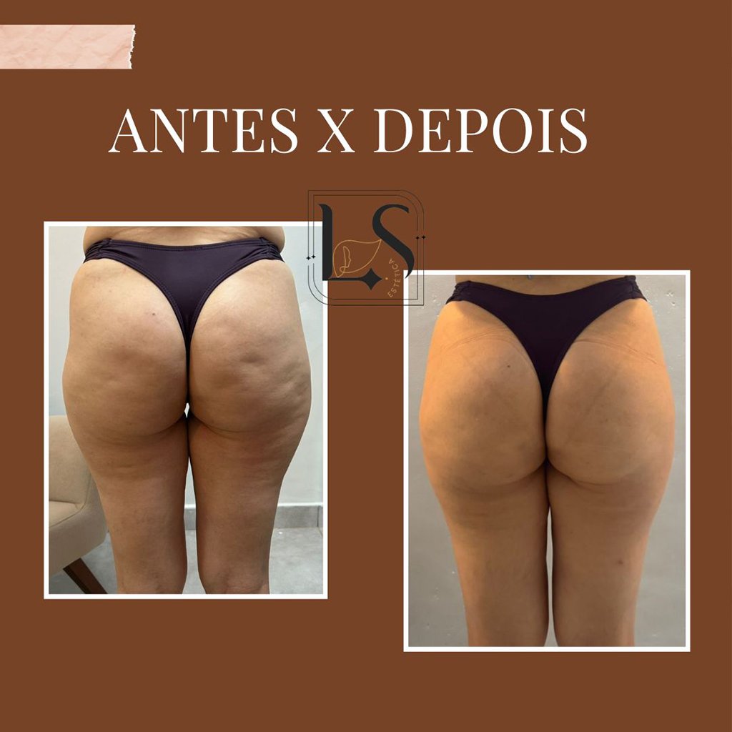 Resultado de preenchimento